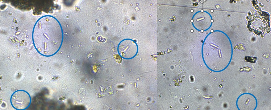 Oválné spory objevující se pod pokožkou při mikroskopování tkáně kořene i stonku řepky Foto archiv Monas Technology