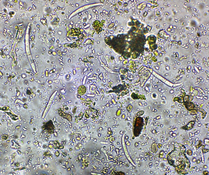 Srpovité velké spory Fusaria z přírodního vzorku Foto archiv Monas Technology
